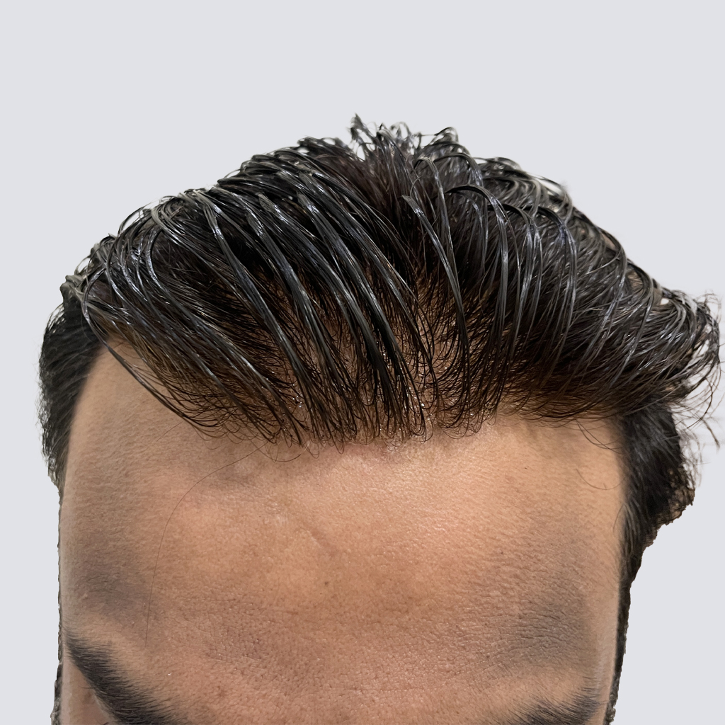 Hair System 11