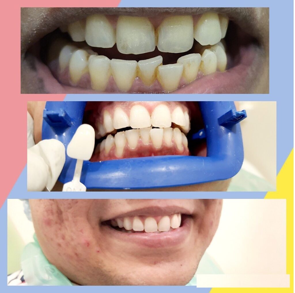 Dental in Mumbai Central